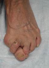 Photos of Good Foot Doctor Near Me