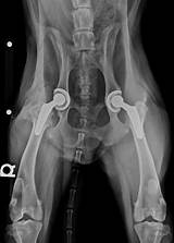 Photos of Partial Hip Replacement Recovery Time Elderly