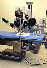 Robot Surgery Images