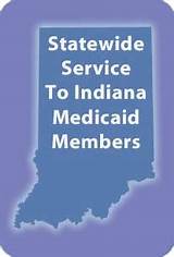 Indiana Medicaid Customer Service Images