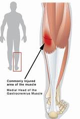 Torn Thigh Muscle Recovery Time Images