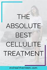 Pictures of Best Treatment For Cellulite 2017