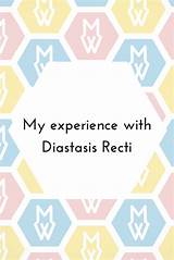 Photos of Diastasis Recti Recovery
