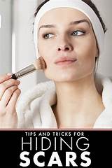 Makeup Tips For Covering Acne Photos