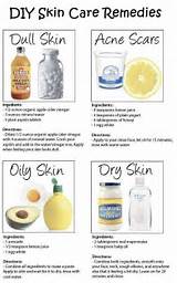 Images of Face Clearing Home Remedies