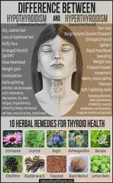 Overactive Thyroid Home Remedies Pictures