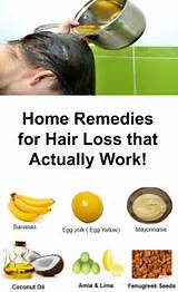 Hair Loss Home Remedies That Work Photos