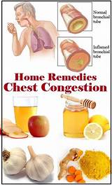 Home Remedies For Gas In Chest