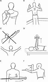 Occupational Therapy Shoulder Exercises Photos