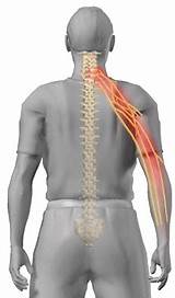 Ice Or Heat For Pinched Nerve In Back Images