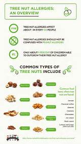 Cashew Allergy Treatment Images
