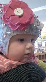 Images of Cranial Helmets For Babies