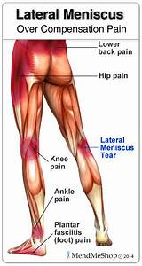Can A Medial Meniscus Tear Heal Without Surgery Images