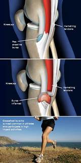 Knee Doctor Scottsdale Pictures