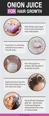 Photos of Onion Home Remedies For Hair Growth