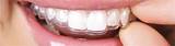 Picture Of Orthodontic Retainer Pictures