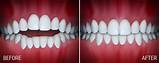 Photos of Scott Orthodontics Silver Spring Md