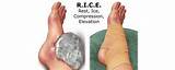 Images of How To Ice An Ankle Sprain