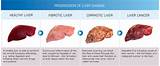 Type Of Doctor For Liver Problems Photos
