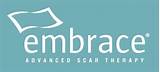 Embrace Scar Therapy Images