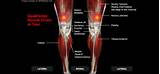 Images of Quadriceps Femoris Muscle Exercises