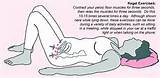 Pictures of Surgery To Tighten Pelvic Floor Muscles