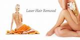How Many Laser Hair Removal Treatments Pictures