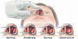Images of Doctor For Sinus Problems