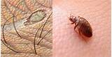 Photos of Car Treatment For Bed Bugs