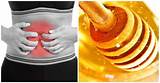 What To Take For Stomach Gas Cramps Pictures