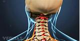 Side Effects Of Pinched Nerve In Lower Back