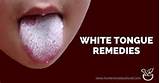 Tongue Thrush Home Remedies Pictures