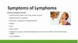 Images of Lymphoma Symptoms Treatment