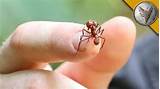 Images of Carpenter Ant Bites On Humans