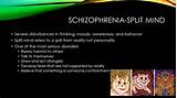 Images of Schizophrenia Mind Control