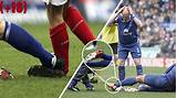 Images of Injuries In Soccer