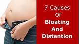 Causes Of Abdominal Bloating And Gas Pictures