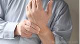 Humira For Rheumatoid Arthritis Side Effects