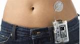 Images of The Insulin Pump