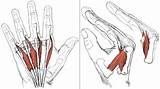 Pictures of Intrinsic Muscle Strengthening Of The Hand