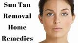 Photos of Sun Tan Home Remedies