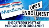 How To Change Medicare Plans During Open Enrollment Photos