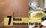 Images of Home Remedies To Treat Lice