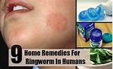 Cure For Sure Home Remedies Pictures