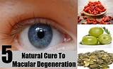 Vitamin Therapy For Macular Degeneration