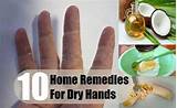 Images of Dry Hands Home Remedies