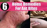 Ant Remedies Pictures