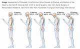 Omohyoid Muscle Strengthening