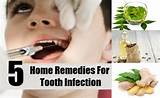 Tooth Infection Antibiotics Home Remedies Photos