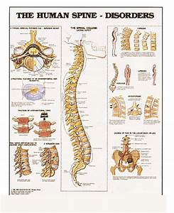 Human Spine Disorders Anatomical Chart Images And Photos Finder